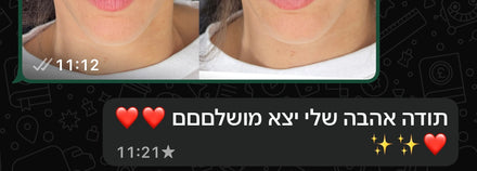 המלצת לקוחה 10